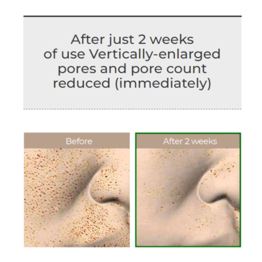 Before and after using VT reedle shot 100 | K-Beauty Blossom