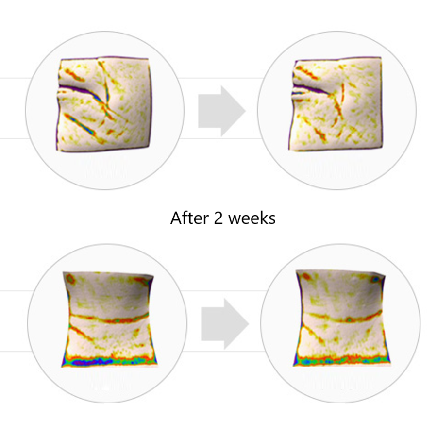 Effect of Rejuran Turnover Ampoule | K-Beauty Blossom USA