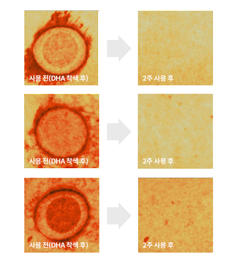 Rejuran Turnover Ampoule Dual Effect Essence