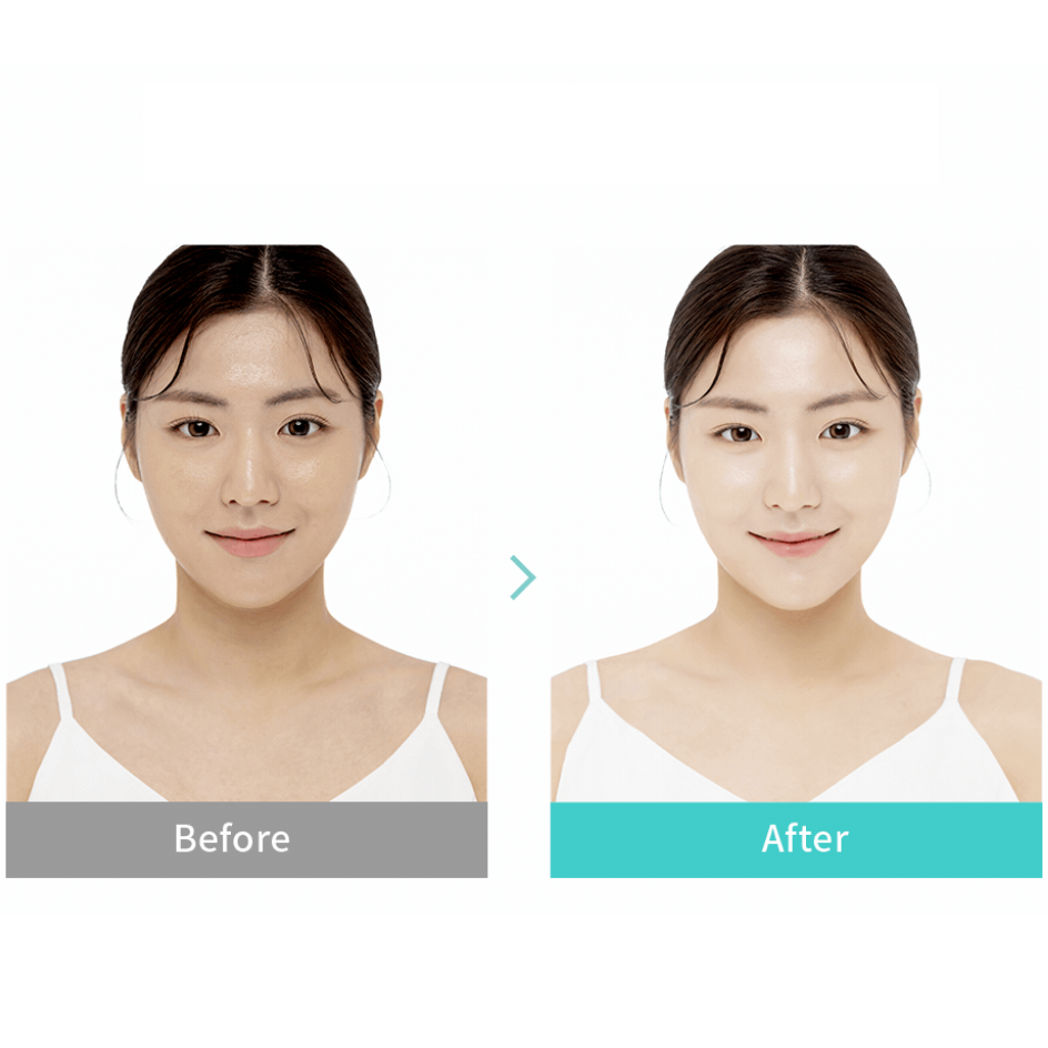 Rejuran Biome Healer Youth Formula Suncream Spf50 + Pa + + + + Suncare