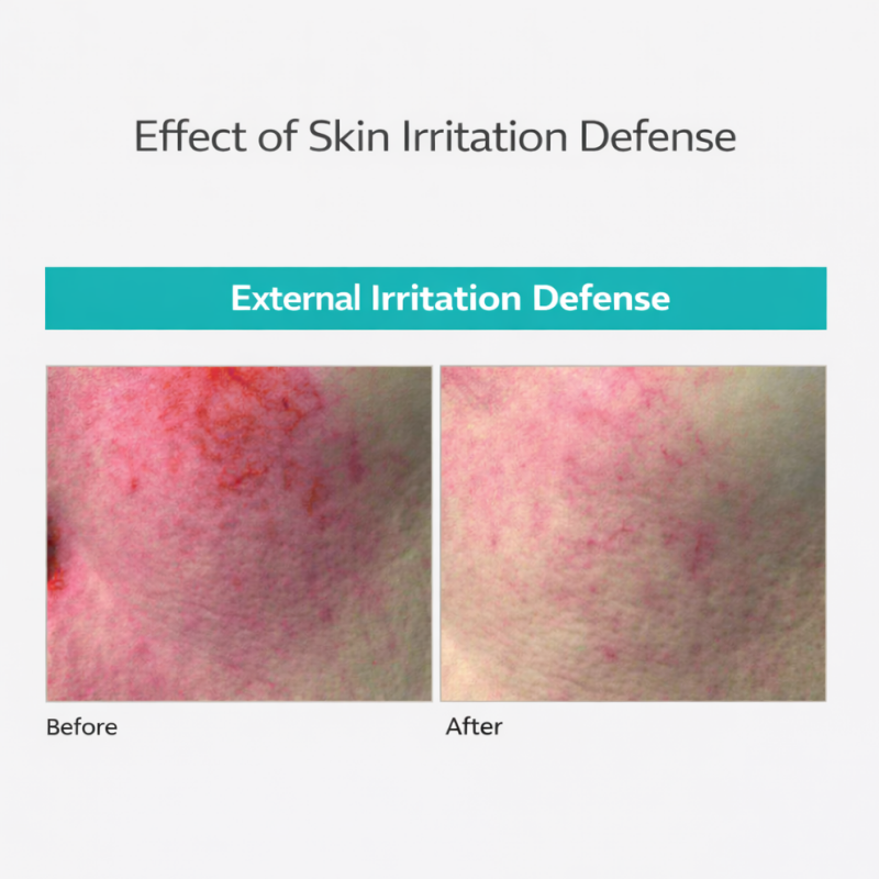 REJURAN Turnover Cream | K-Beauty Blossom USA