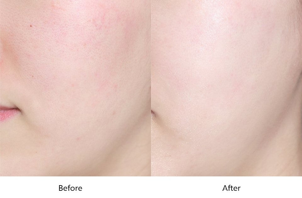 before and after applying laneige water bank hyaluronic cream moisturizer 
