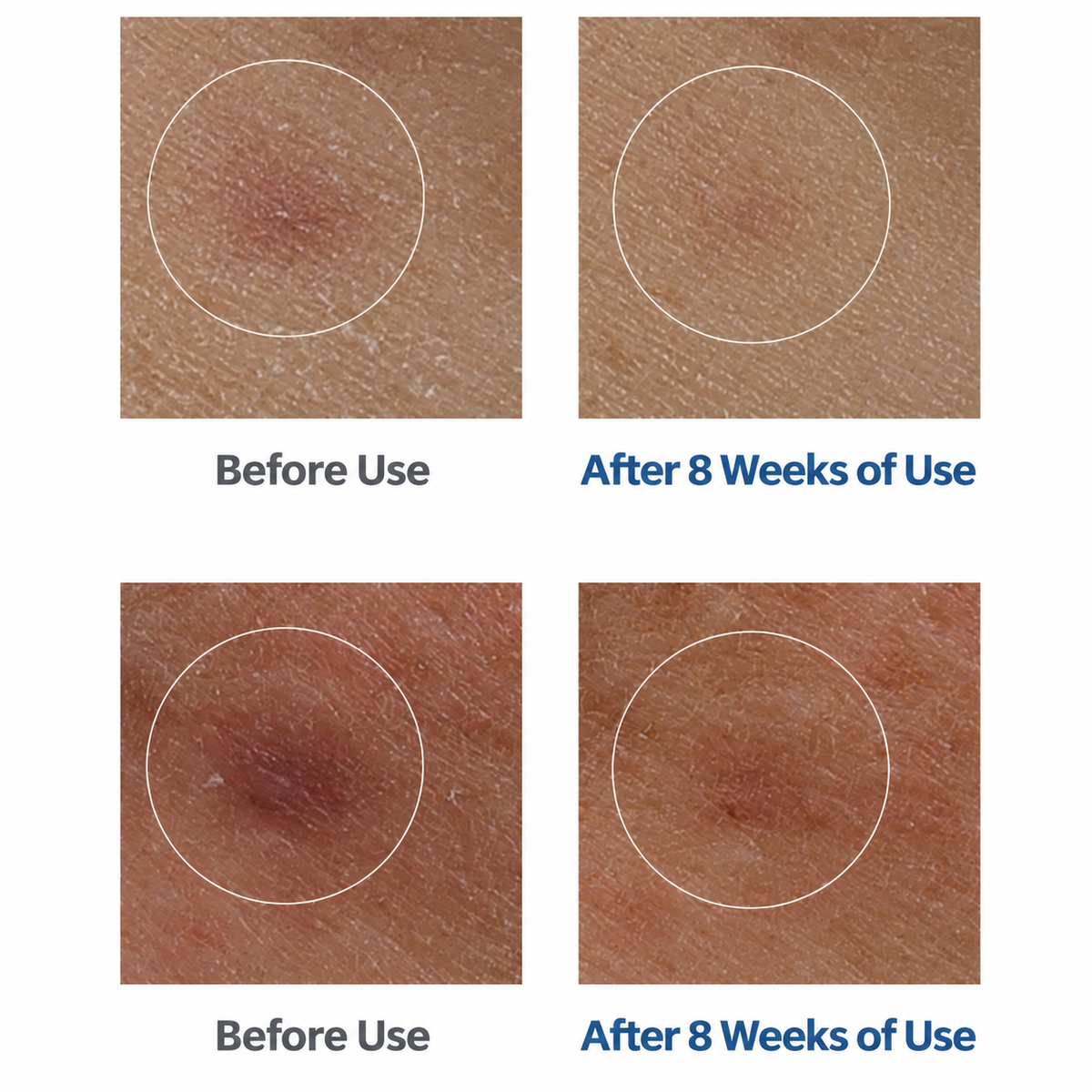 before and after using lumiwise essence water and emulsion