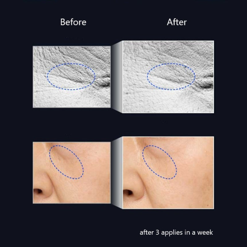 IOPE Retinol Expert 0.5% Ultimate Concentrate essence