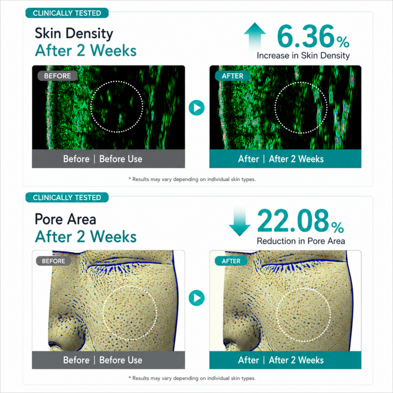 REJURAN Ampoule Infused Lifting Mask, powered by c-PDRN