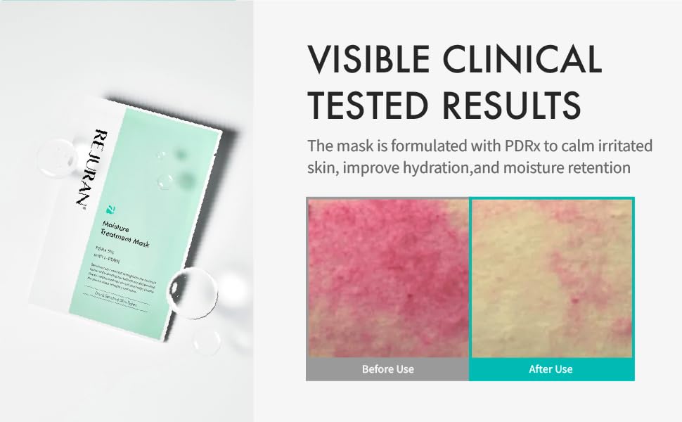 Rejuran moisture treatment mask | K-Beauty Blossom USA