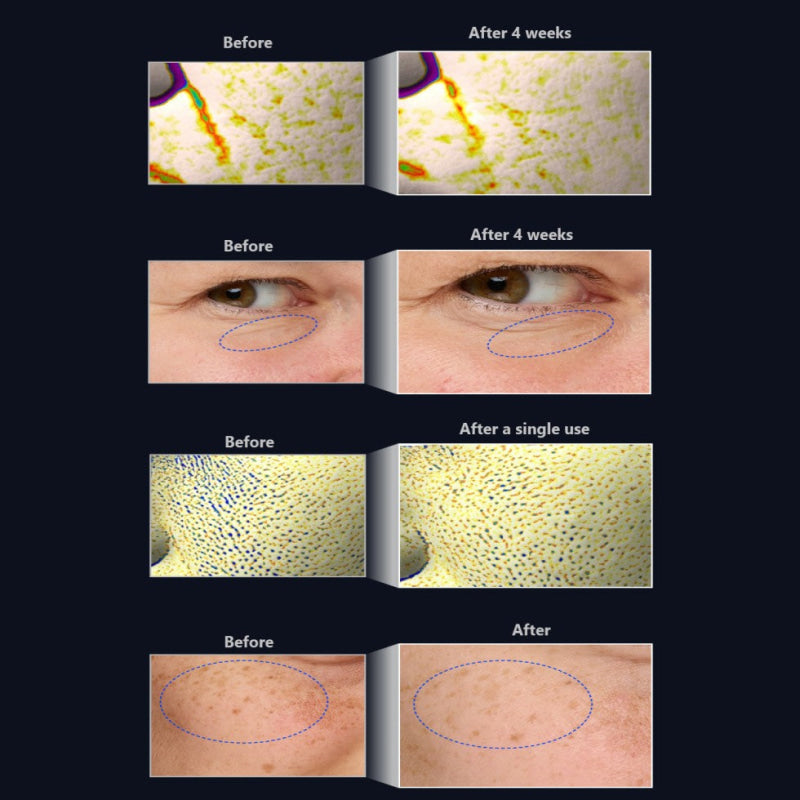 IOPE Retinol retijection serum | K-Beauty Blossom USA