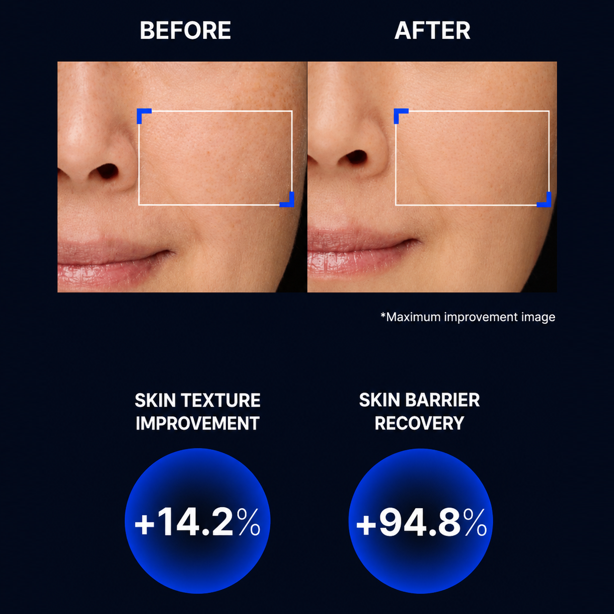 Before and after results showing smoother skin texture and refined pores with IOPE Retinol Super Bounce Serum RX