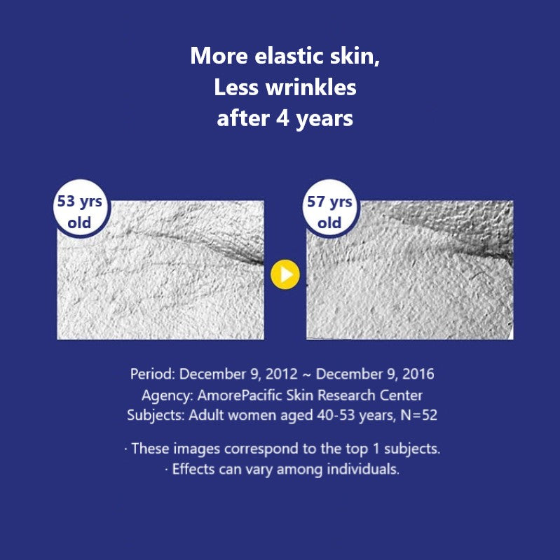 4 years later after using IOPE Retinol Expert 0.1% | K-Beauty Blossom USA