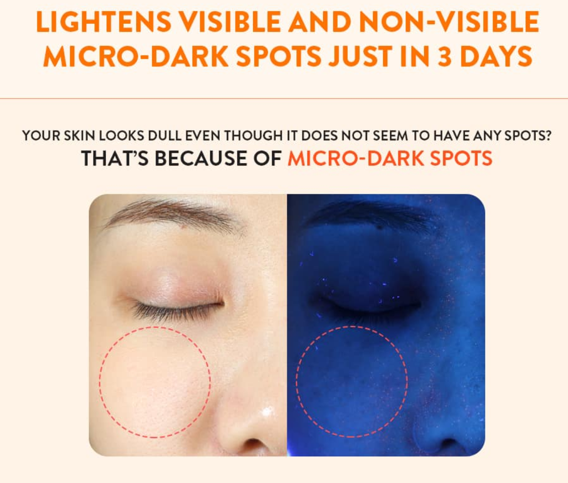micro-dark spots 